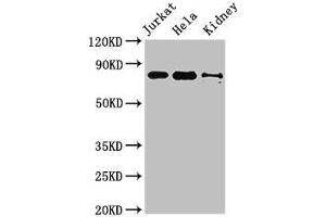 Western Blot Positive WB detected in: Jurkat whole cell lysate, Hela whole cell lysate, Mouse kidney tissue All lanes: NOA1 antibody at 3. (C4orf14 抗体  (AA 42-174))