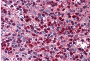 Human Spleen: Formalin-Fixed, Paraffin-Embedded (FFPE) (SIRT6 抗体  (C-Term))