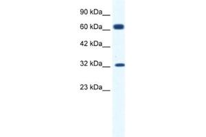Western Blotting (WB) image for anti-Potassium Intermediate/small Conductance Calcium-Activated Channel, Subfamily N, Member 1 (KCNN1) antibody (ABIN2461099) (KCNN1 抗体)