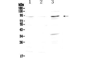 Western blot analysis of FOXP2 using anti-FOXP2 antibody . (FOXP2 抗体  (AA 637-715))