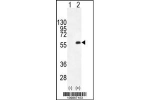 Western blot analysis of PKMYT1 using rabbit polyclonal PKMYT1 C-term using 293 cell lysates (2 ug/lane) either nontransfected (Lane 1) or transiently transfected (Lane 2) with the PKMYT1 gene. (MYT1 抗体  (C-Term))