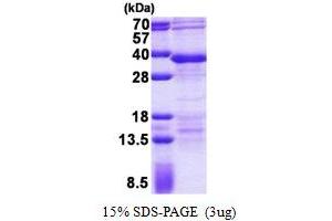 SDS-PAGE (SDS) image for Regulatory Factor X-Associated Ankyrin Containing Protein (RFXANK) (AA 1-237) protein (His tag) (ABIN6387233)