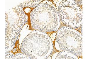 ABIN6257536 and ABIN6274704 at 1/100 staining Rat testis tissue by IHC-P. (TRAF3IP3 抗体  (Internal Region))