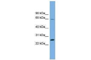 DHFRL1 antibody used at 1 ug/ml to detect target protein. (DHFRL1 抗体  (Middle Region))