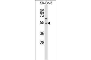 Western blot analysis in SK-BR-3 cell line lysates (35ug/lane). (PPM1A 抗体  (AA 355-382))