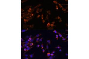 Immunofluorescence (IF) image for anti-Proteasome (Prosome, Macropain) Subunit, beta Type, 7 (PSMB7) (AA 44-200) antibody (ABIN7269594)