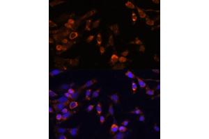 Immunofluorescence analysis of NIH-3T3 cells using PSMB7 Polyclonal Antibody (ABIN7269594) at dilution of 1:100 (40x lens).