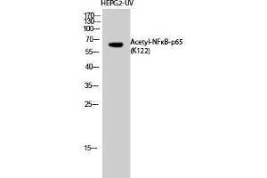 Western Blotting (WB) image for anti-Nuclear Factor-kB p65 (NFkBP65) (acLys122) antibody (ABIN3178882) (NF-kB p65 抗体  (acLys122))