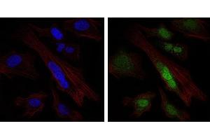 Immunofluorescence analysis of Hela cells using SOX9 mouse mAb (green). (SOX9 抗体)