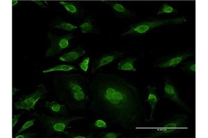 Immunofluorescence of monoclonal antibody to MAPK10 on HeLa cell. (MAPK10 抗体  (AA 1-319))