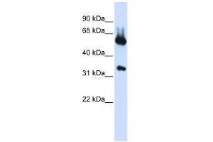 ALAS2 antibody used at 1 ug/ml to detect target protein.