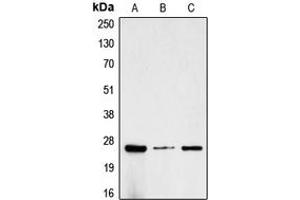 Western blot analysis of CG beta expression in MCF7 (A), SP2/0 (B), rat kidney (C) whole cell lysates. (CGB 抗体  (C-Term))