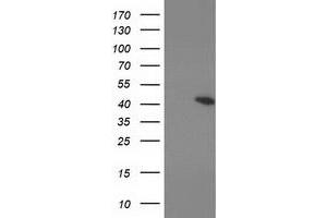Western Blotting (WB) image for anti-Protein Kinase, CAMP-Dependent, Regulatory, Type I, beta (PRKAR1B) antibody (ABIN1500409) (PRKAR1B 抗体)