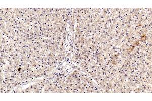 Immunohistochemistry (IHC) image for anti-Angiotensinogen (serpin Peptidase Inhibitor, Clade A, Member 8) (AGT) antibody (ABIN7437461)