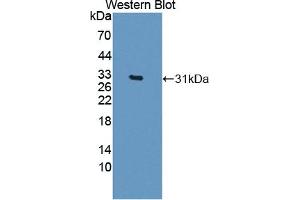 Detection of Recombinant CELSR3, Human using Polyclonal Antibody to Cadherin EGF LAG Seven Pass G-Type Receptor 3 (CELSR3) (CELSR3 抗体  (AA 1181-1421))