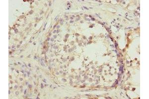 Immunohistochemistry of paraffin-embedded human testis tissue using ABIN7167503 at dilution of 1:100 (PTPRE 抗体)