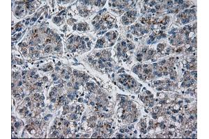 Immunohistochemical staining of paraffin-embedded Ovary tissue using anti-PRLmouse monoclonal antibody. (Prolactin 抗体)