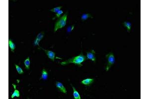 Immunofluorescence (IF) image for anti-Solute Carrier Family 25 (Mitochondrial Carrier), Member 18 (SLC25A18) (AA 246-287) antibody (ABIN7159878)