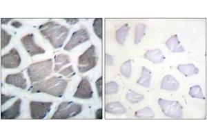 Immunohistochemistry analysis of paraffin-embedded human skeletal muscle tissue, using Bak Antibody. (BAK1 抗体  (AA 1-50))