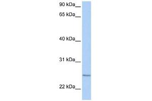RABL4 antibody used at 1 ug/ml to detect target protein. (RABL4 抗体  (C-Term))