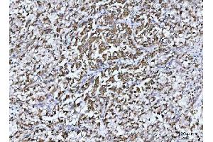IHC analysis of GLUD1/2 using anti-GLUD1/2 antibody (ABIN7602000). (GLUD1 / GLUD2 (AA 54-553) 抗体)