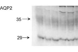 Western blot analysis of Rat kidney inner medullary homogenates showing detection of Aquaporin 2 protein using Rabbit Anti-Aquaporin 2 Polyclonal Antibody . (AQP2 抗体  (C-Term) (FITC))
