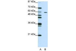 Western Blot showing ZNF382 antibody used at a concentration of 1-2 ug/ml to detect its target protein. (ZNF382 抗体  (N-Term))