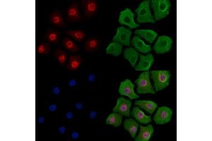 Phospho-YY1 (Ser365) Antibody staining Hela cells(heat shock treatment) by IF/ICC. (YY1 抗体  (pSer365))