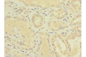 Immunohistochemistry of paraffin-embedded human kidney tissue using ABIN7151868 at dilution of 1:100 (EPH Receptor B4 抗体  (AA 300-540))