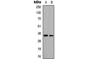 Western blot analysis of CD34 expression in HeLa (A), HepG2 (B) whole cell lysates. (CD34 抗体  (Center))
