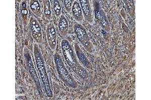 IHC analysis of PDIA6 using anti-PDIA6 antibody (ABIN7600553). (PDIA6 抗体  (AA 20-440))