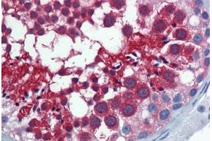 Human Testis: Formalin-Fixed, Paraffin-Embedded (FFPE) (Importin 5 抗体  (AA 1-101))