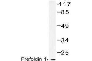Western blot (WB) analysis of Prefoldin 1 antibody in extracts from RAW264. (PFDN1 抗体)