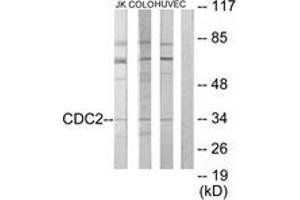 Western Blotting (WB) image for anti-Cyclin-Dependent Kinase 1 (CDK1) (AA 101-150) antibody (ABIN2889380) (CDK1 抗体  (AA 101-150))