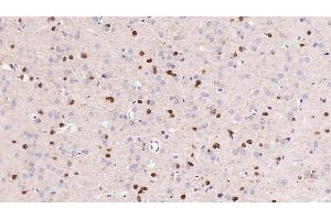 Detection of NGAL in Rat Cerebrum Tissue using Monoclonal Antibody to Neutrophil gelatinase-associated lipocalin (NGAL) (Lipocalin 2 抗体  (AA 21-198))