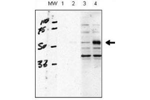Western Blotting (WB) image for anti-Activin A Receptor Type II-Like 1 (ACVRL1) (AA 38-68) antibody (ABIN3029853)