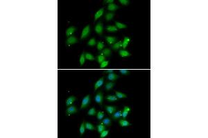 Immunofluorescence analysis of HeLa cell using PPP2CA antibody. (PPP2CA 抗体)