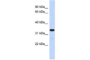 FAM76A antibody used at 1 ug/ml to detect target protein. (FAM76A 抗体  (N-Term))