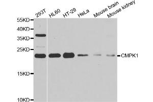 Western blot analysis of extracts of various cell lines, using CMPK1 antibody (ABIN5973940) at 1/1000 dilution. (Cytidine Monophosphate (UMP-CMP) Kinase 1, Cytosolic (CMPK1) 抗体)