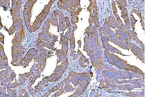 IHC analysis of RALBP1 using anti-RALBP1 antibody (ABIN7600800). (RALBP1 抗体  (AA 239-506))