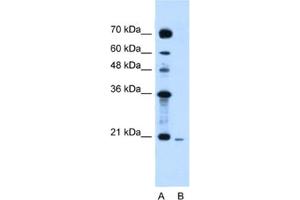 Western Blotting (WB) image for anti-Synovial Sarcoma, X Breakpoint 2 (SSX2) antibody (ABIN2461583) (SSX2 抗体)