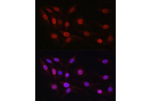 Immunofluorescence analysis of NIH/3T3 cells using SP1 Rabbit pAb (ABIN7270506) at dilution of 1:50 (40x lens). (SP1 抗体  (AA 420-620))