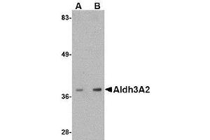 Western blot analysis of Aldh3A2 in mouse liver lysate with AP30044PU-N Aldh3A2 antibody at (A) 1 and (B) 2 μg/ml. (ALDH3A2 抗体  (C-Term))