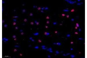 Immunofluorescent analysis of paraformaldehyde-fixed rat hippocampus using ZNF154 (ABIN7076261) at dilution of 1: 1000 (ZNF154 抗体)