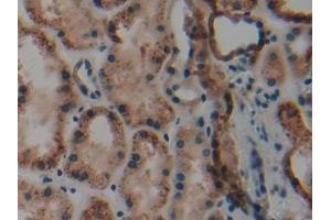 Immunohistochemistry (IHC) image for anti-Keratin 9 (KRT9) (AA 315-456) antibody (ABIN7431980)