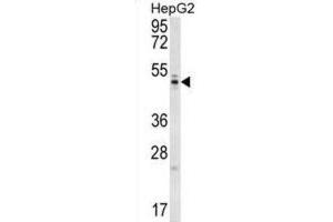 Western Blotting (WB) image for anti-WD Repeat Domain 12 (WDR12) antibody (ABIN2997125) (WDR12 抗体)
