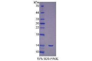 SDS-PAGE (SDS) image for Follicle Stimulating Hormone Receptor (FSHR) (AA 18-113) protein (His tag) (ABIN1079595) (FSHR Protein (AA 18-113) (His tag))
