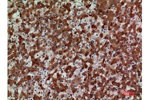Immunohistochemistry (IHC) analysis of paraffin-embedded Human Liver, antibody was diluted at 1:100. (CCR3 抗体  (N-Term))