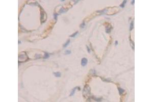 IHC-P analysis of Human Tissue, with DAB staining. (IL12RB1 抗体  (AA 37-234))
