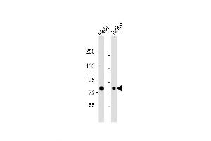 Western Blot at 1:1000 dilution Lane 1: Hela whole cell lysate Lane 2: Jurkat whole cell lysate Lysates/proteins at 20 ug per lane. (HADHA 抗体  (C-Term))